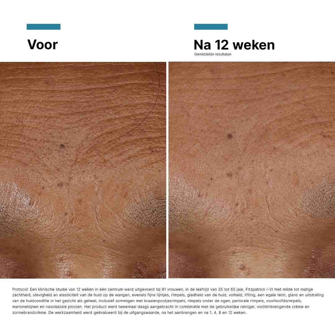 HA Intensifier Multi-Glycan