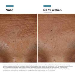 HA Intensifier Multi-Glycan