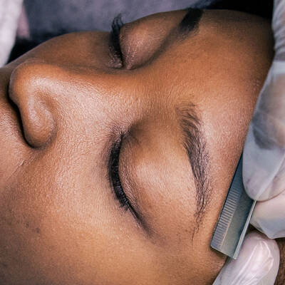 IPL Laser