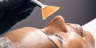 Medium Chemische Peeling