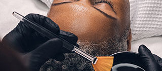 Diepe chemische peeling