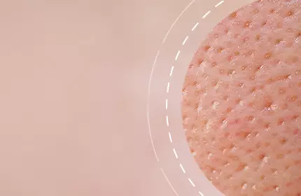 Close-up of textured skin, highlighting pores and surface details against a soft, blurred background.