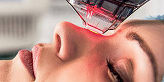 Non-Ablatieve Laser