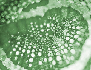 Microscopisch beeld van een groene schijf, met een patroon van holtes en cellen zichtbaar in detail.