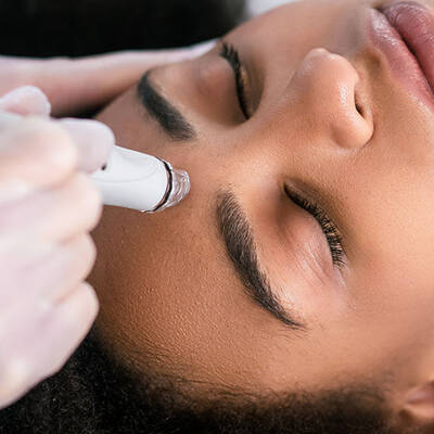 IPL Laser