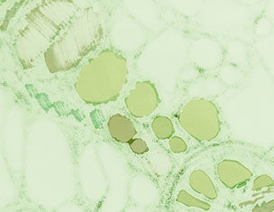 Microscopisch beeld van plantencellen met groene chloroplasten op een lichte achtergrond.