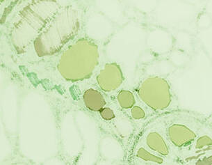 Microscopisch beeld van plantencellen met groene chloroplasten op een lichte achtergrond.