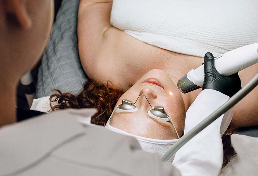 Een vrouw ondergaat een laserbehandeling in een clinic, met beschermende bril en een behandelend specialist.