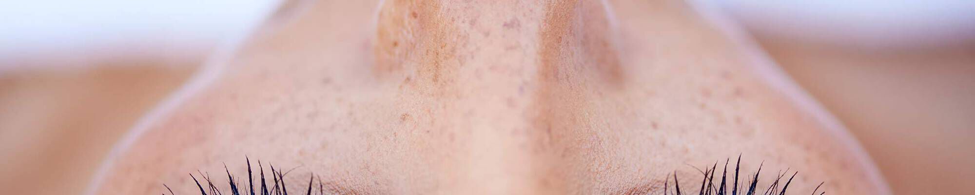 Close-up of a person's forehead and eyes, showcasing natural skin with freckles and long eyelashes.