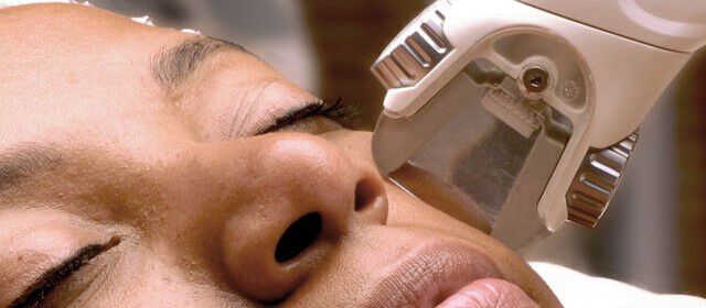 Ultherapy