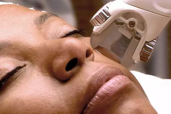 Een close-up van een vrouw die een gezichtsbehandeling ondergaat met een apparaat dat de huid behandelt.