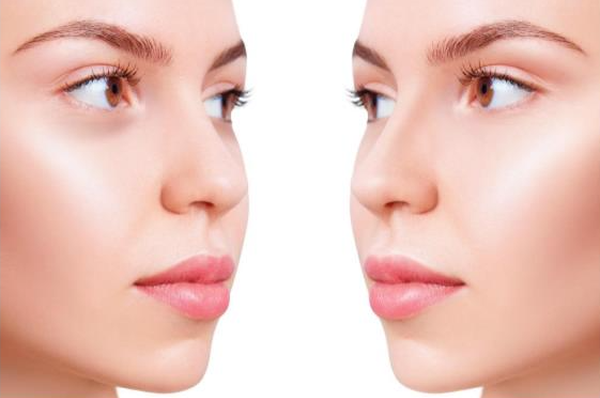 Twee zijaanzichten van een vrouwelijk gezicht met een zachte huid en een neutrale uitstraling.