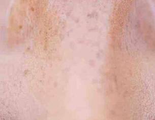 alles-over-glycolzuur-van-cremes-tot-peelings